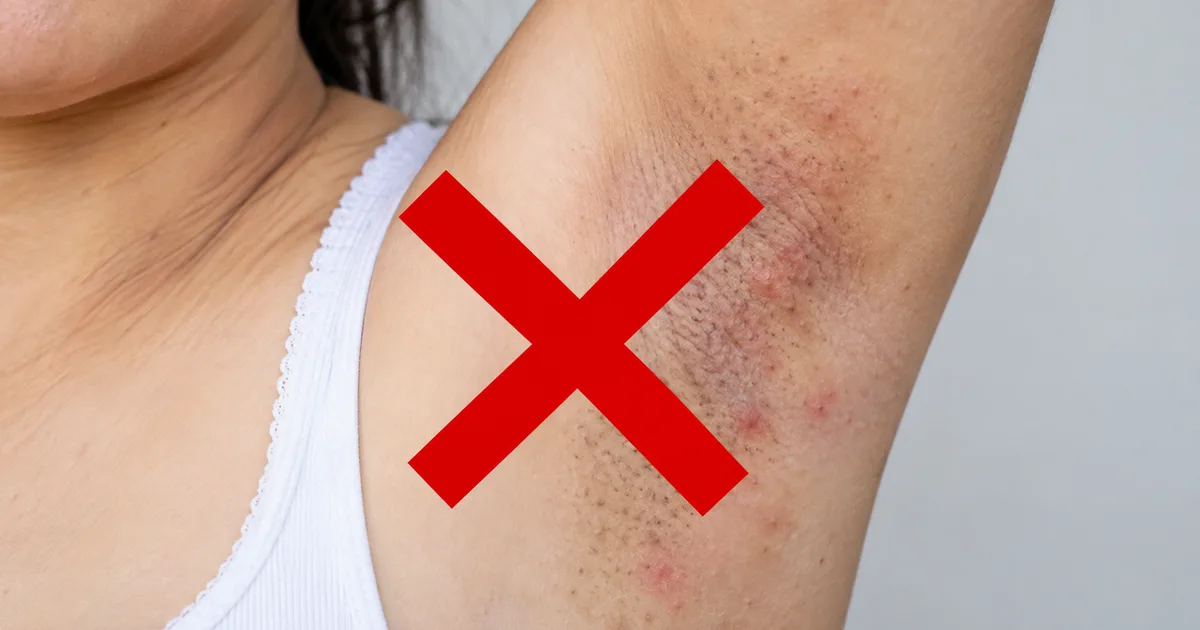 Cuidados seguros para manchas nas axilas e virilhas
