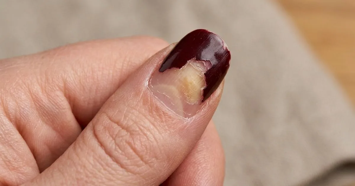 A durabilidade do esmalte depende mais da preparação do que da quantidade