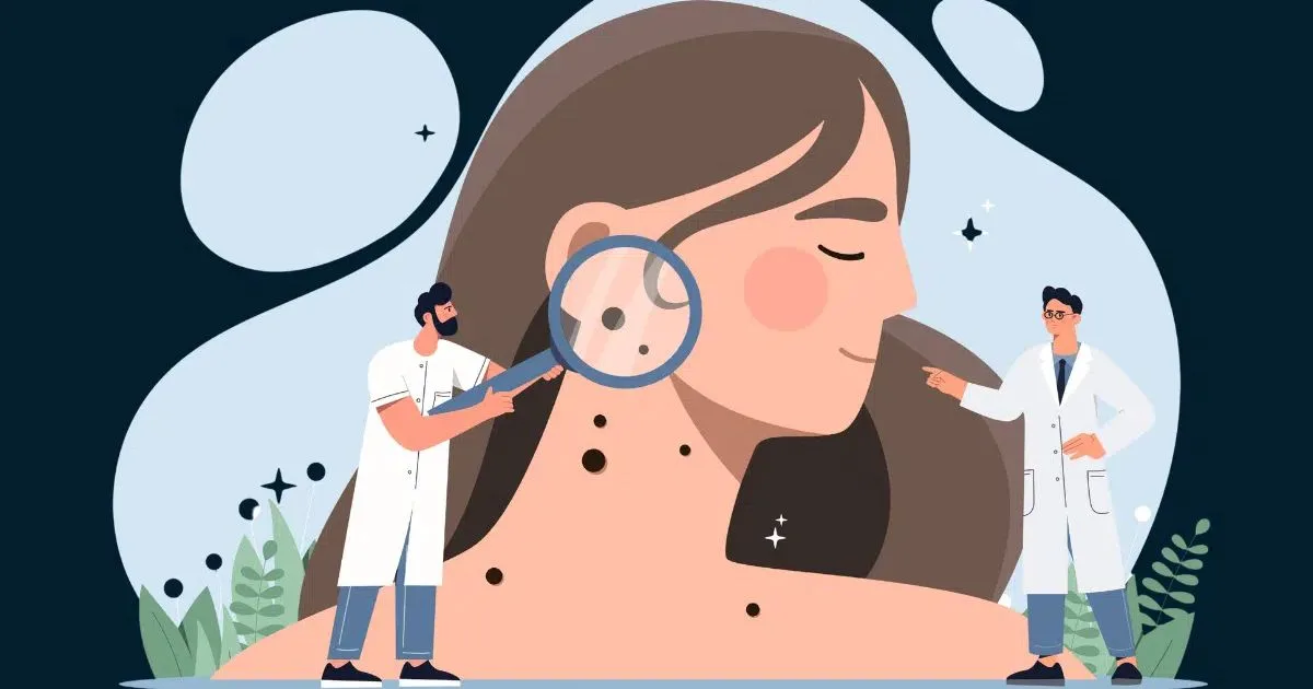 Acesso limitado e longa duração marcam cirurgia micrográfica de Mohs
